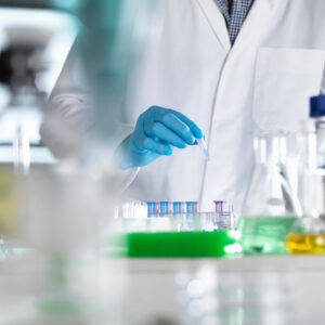 Scientist preparing DNA samples for testing in the laboratory