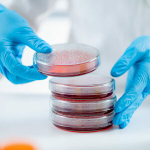 Microbiology bacteria laboratory work. Hands of a microbiologist working in a research facility, moving stacks of Petri dishes with bacteria cultures.